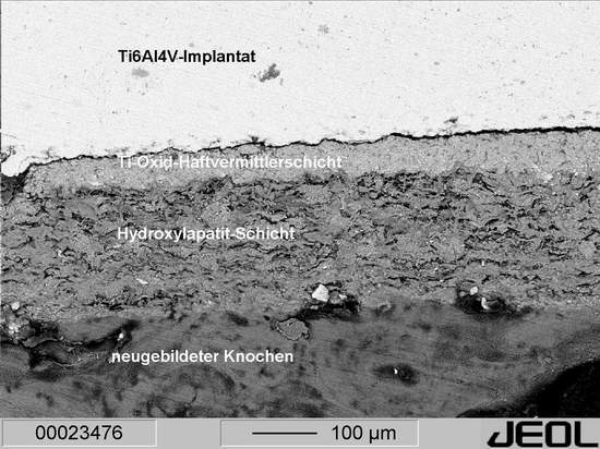 Querschnitt eines mit Hydroxylapatit beschichteten Ti6Al4V-Implantats mit hervorragender Knochenapposition (Hunde-Femur)